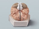 뇌의구조모형(기본형) A형 6261